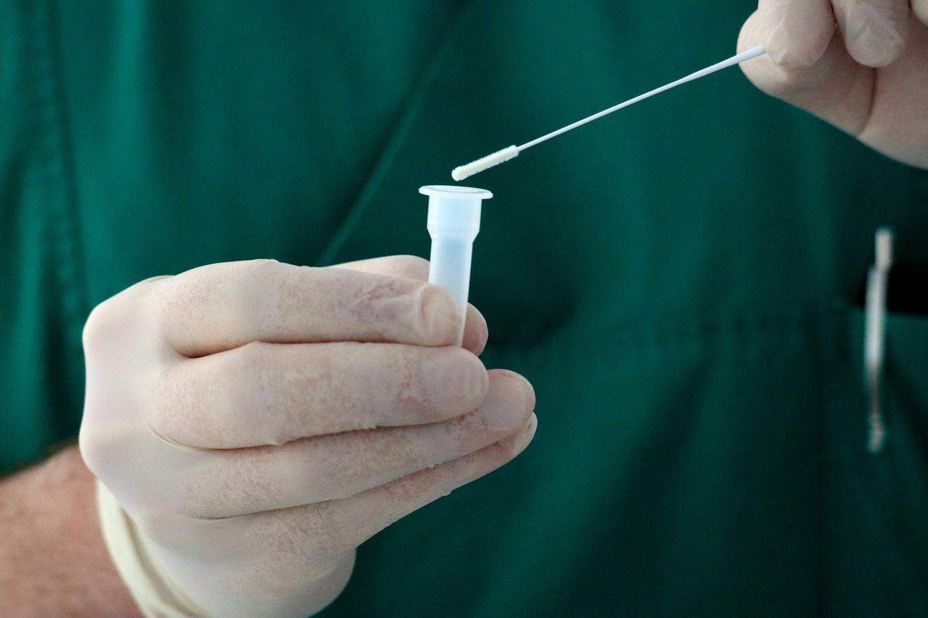 covid koronavirus testiranje foto pixabay