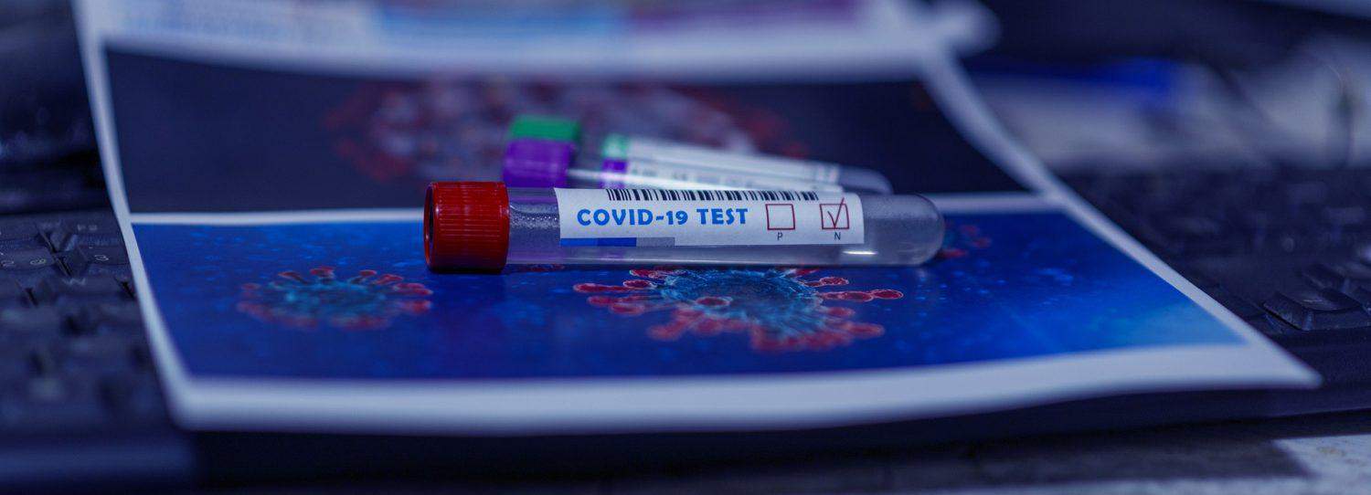 covid koronavirus testiranje foto pixabay