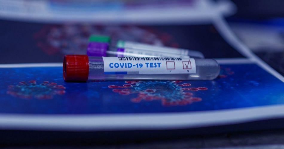 covid koronavirus testiranje foto pixabay